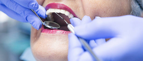 Best Urgent Care for Lost Fillings or Crowns in Stanton, CA