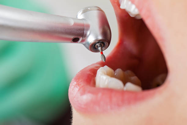 Best Pediatric Emergency Dentist in Stanton, CA